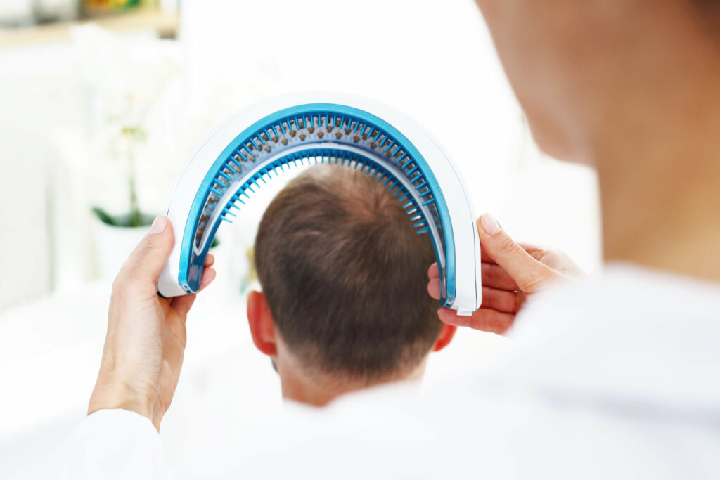 Light therapy being used to treat androgenetic alopecia