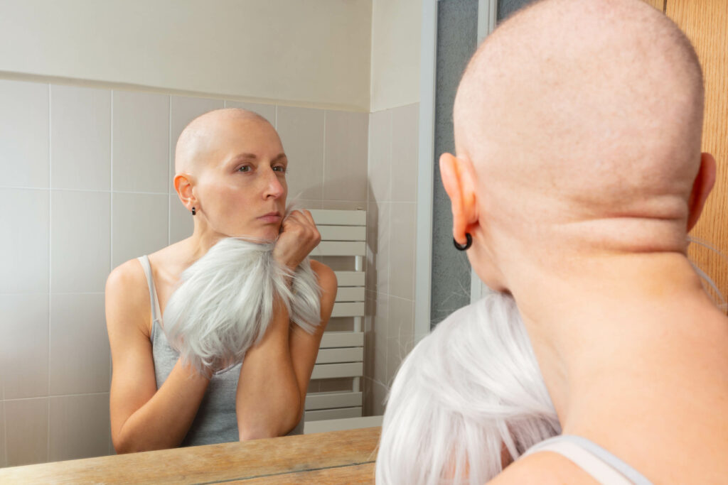 Woman looking in mirror with total hair loss and hand-tied wig