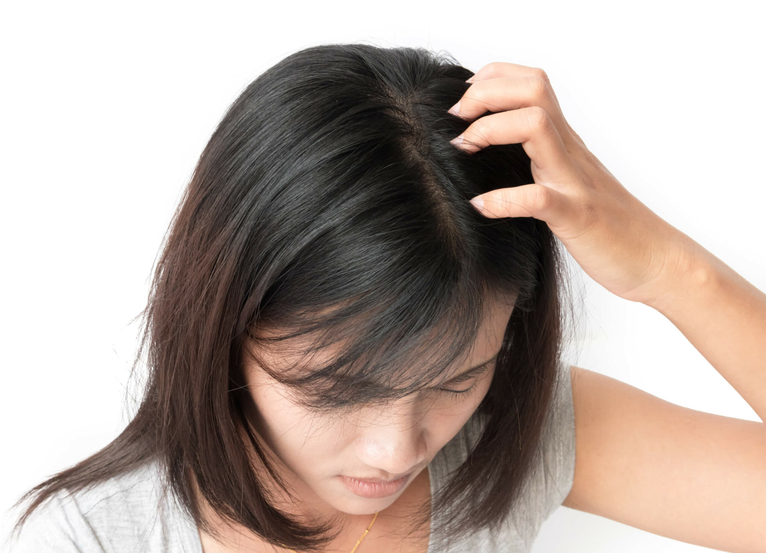 Hair toppers can be used to fill in thinning hair on top