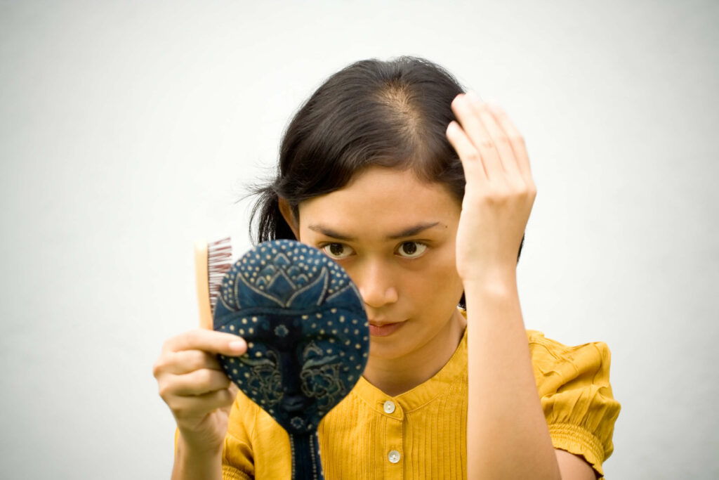 Woman looks in a mirror at hair loss in her part caused by a type of alopecia called telogen effluvium